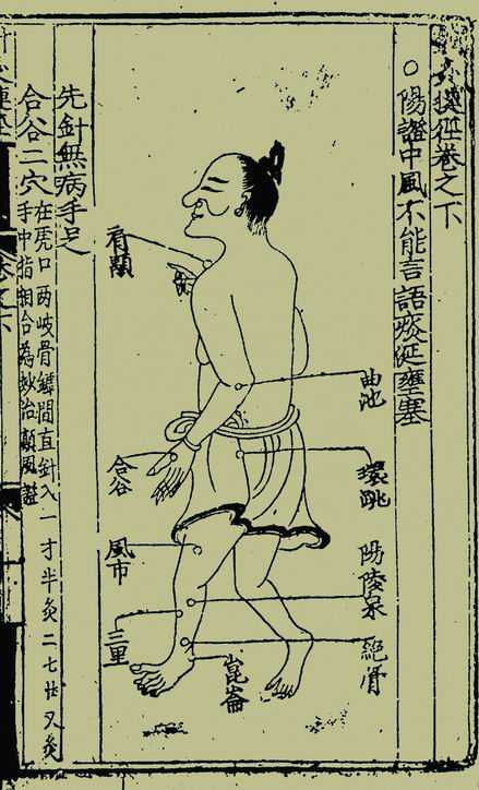 《针灸捷径》