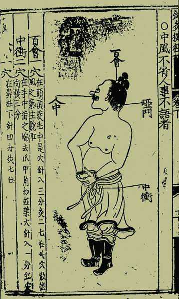 《针灸捷径》