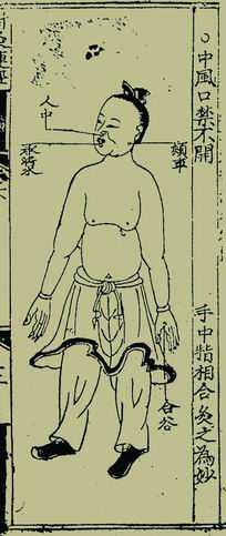 《针灸捷径》