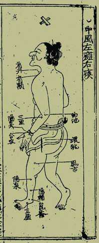 《针灸捷径》