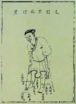 《针灸问答》