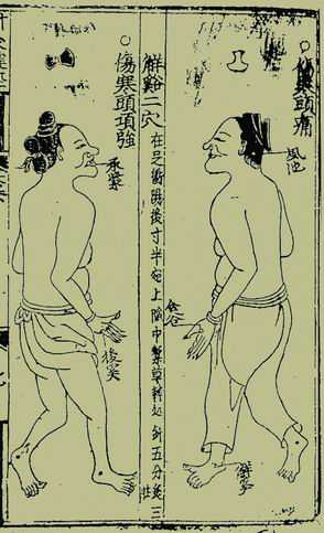 《针灸捷径》