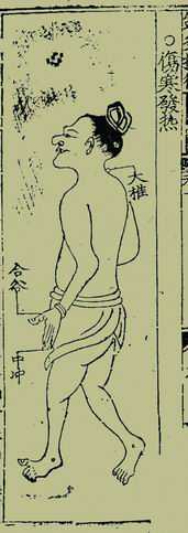 《针灸捷径》