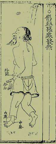 《针灸捷径》