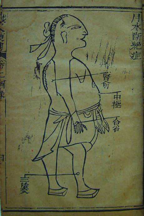 《针灸便用》