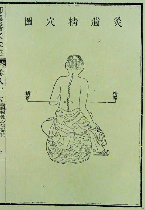 《医宗金鉴》