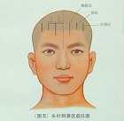 针刺激区5