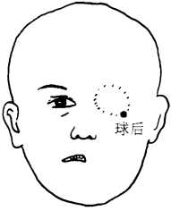 图13-5 图13-5
