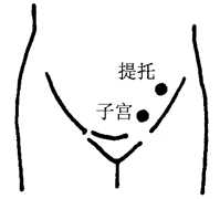 图15-7提托、子宫穴取穴图 图15-7提托、子宫穴取穴图