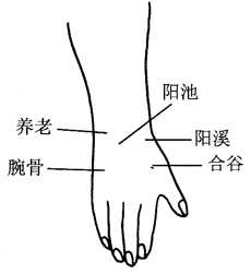 图17-8腕关节损伤取穴图 图17-8腕关节损伤取穴图