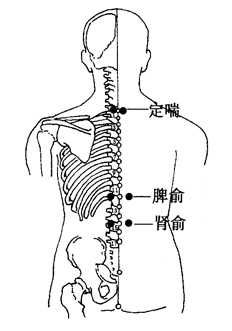 图2-5-4定喘、脾俞、肾俞