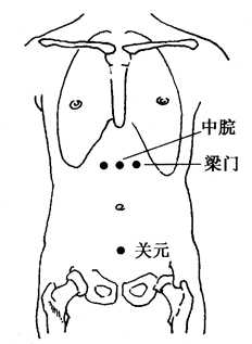 图2-12-3中脘、梁门、关元