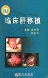 临床肝移植