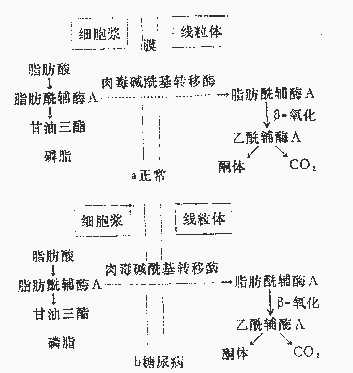 糖尿病酮症酸中毒的可能机制
