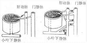 肝硬变时肝内血液循环变化示意图