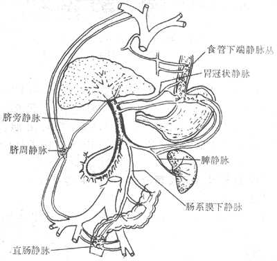 肝硬变时侧支循环模式图