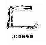 直接喉镜检查法