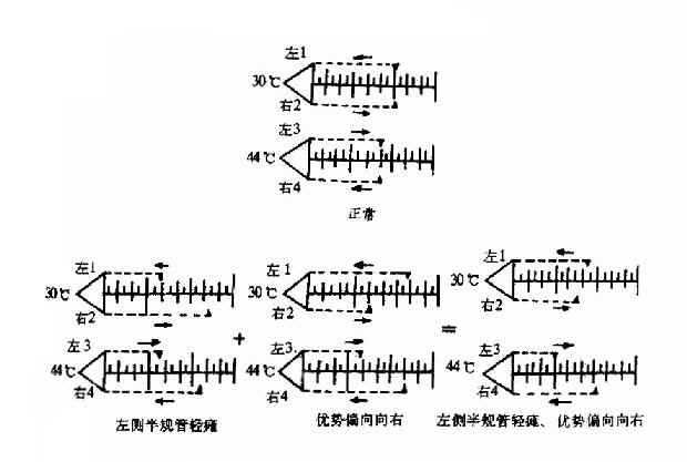 交替冷热试验记录(每小格代表10秒)