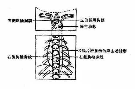 胸椎旁线