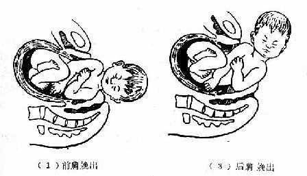 胎尖娩出