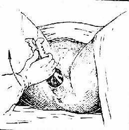 向上提牵