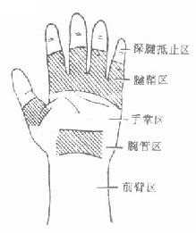 屈肌腱分区