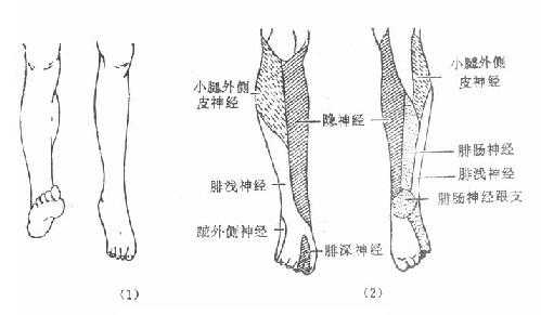 坐骨神经检查及其瘫痪表现