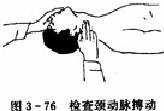 心肺复苏——检查颈动脉