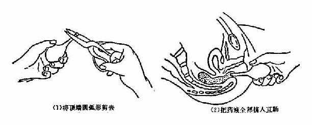 开塞露使用方法