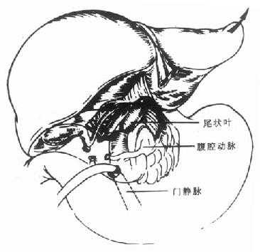 肝门横断后,将肝脏向上翻转,逐根结所肝短静脉