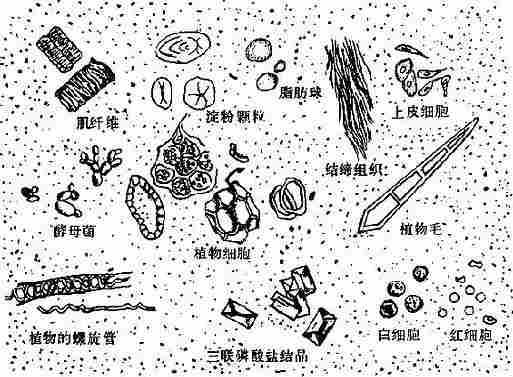 粪便的显微镜所见
