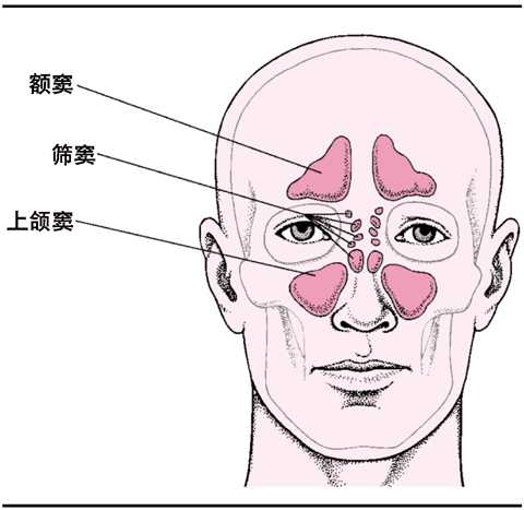 鼻窦炎