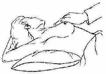 乳腺触诊 病人仰卧,上臂外展