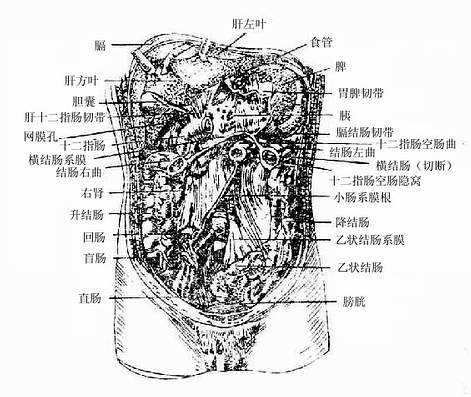 腹膜形成物