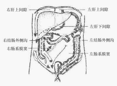 腹膜腔间隙的沟通