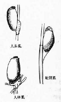 虱卵
