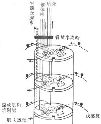 脊髓半离断效应示意图