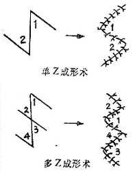 单Z与多Z成形术延长程度比较