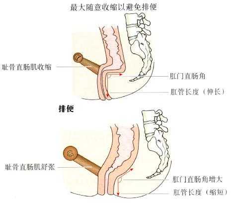 肛门直肠角