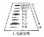 免疫印迹法检查患者血清中的HIV病毒抗体