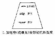 免疫印迹法检查患者血清中的HIV病毒抗体