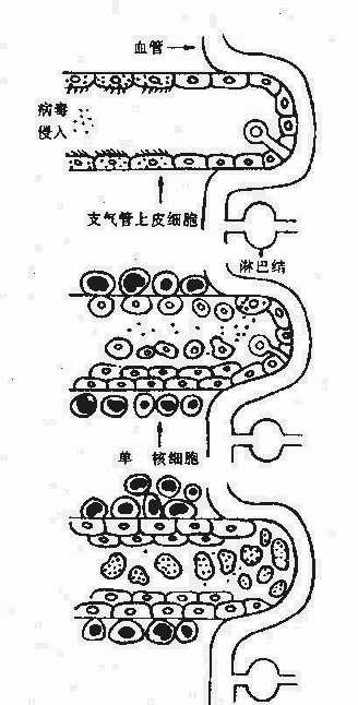 脊髓灰质炎病毒的全身感染(模式图)
