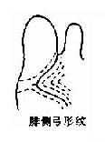 拇指球部纹型
