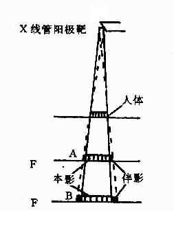 X线管阳极靶对X线投影的(放大与晕影)焦点面使X线投影放