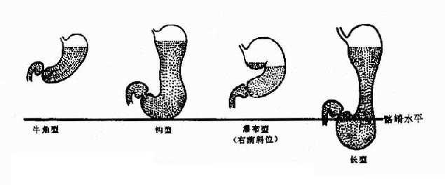 胃的分型