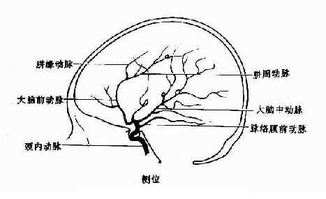 正常颈动脉造影