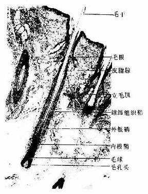 人头皮光镜像(低倍) HE