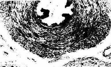 人输精管